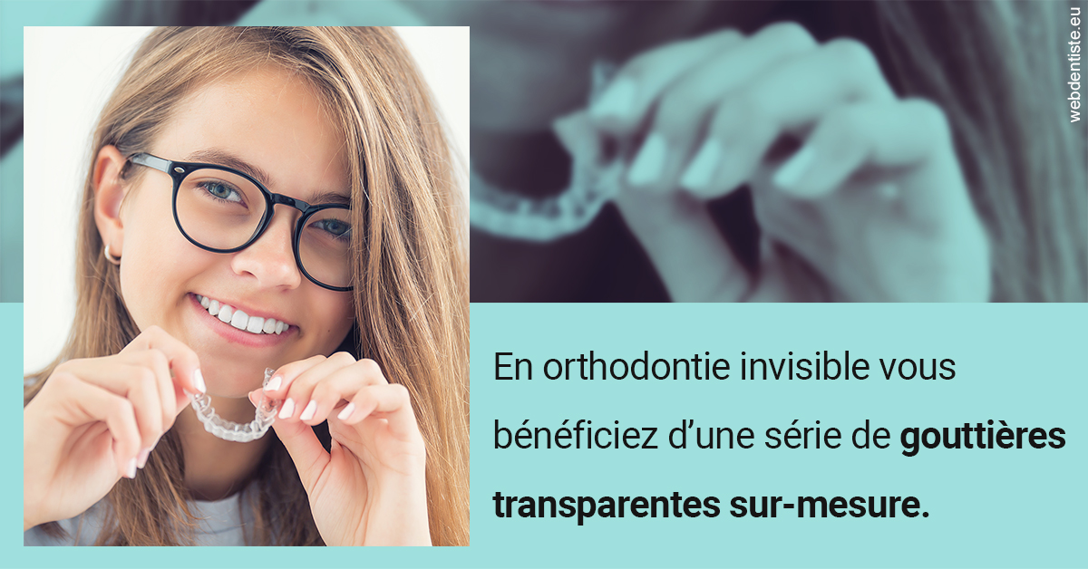 https://www.scm-adn-chirurgiens-dentistes.fr/Orthodontie invisible 2