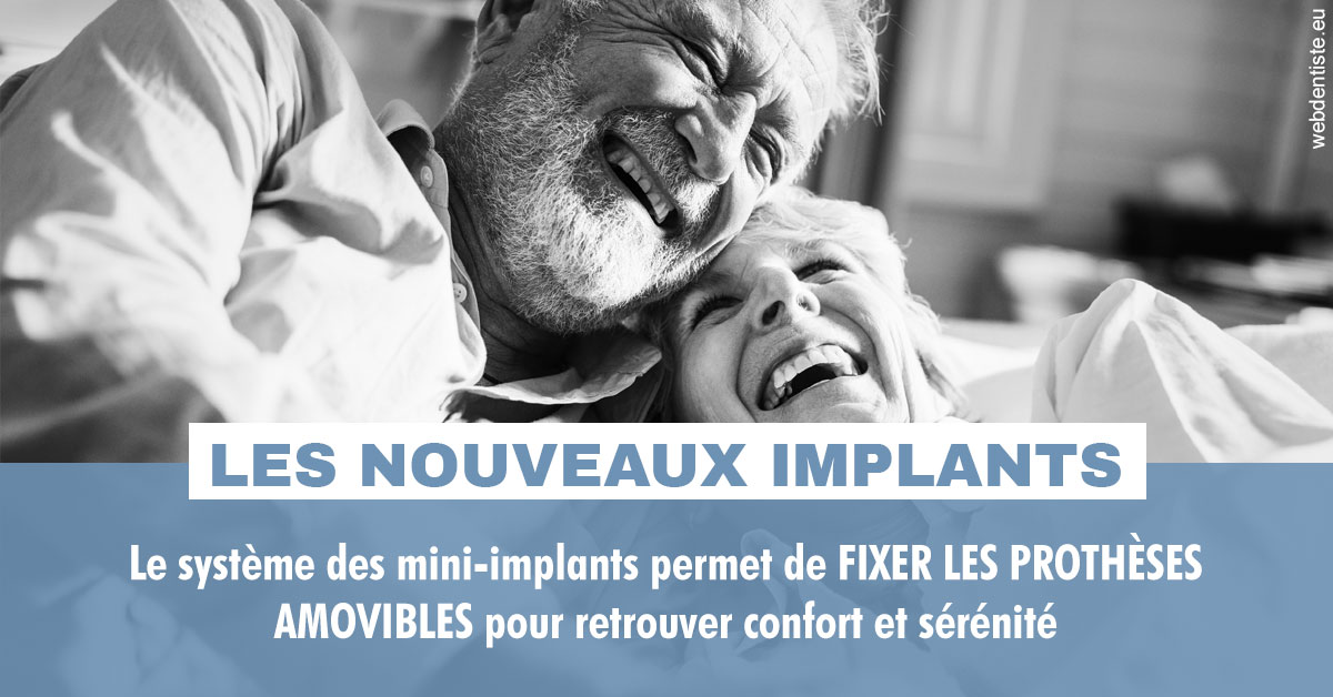 https://www.scm-adn-chirurgiens-dentistes.fr/Les nouveaux implants 2