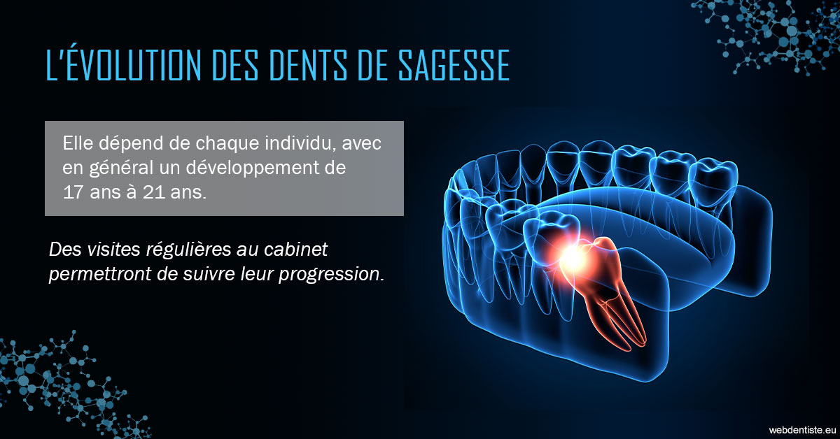 https://www.scm-adn-chirurgiens-dentistes.fr/2023 T4 - Dents de sagesse 01