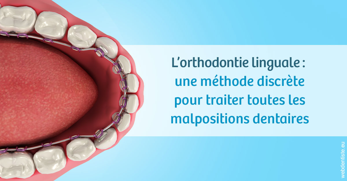 https://www.scm-adn-chirurgiens-dentistes.fr/L'orthodontie linguale 1
