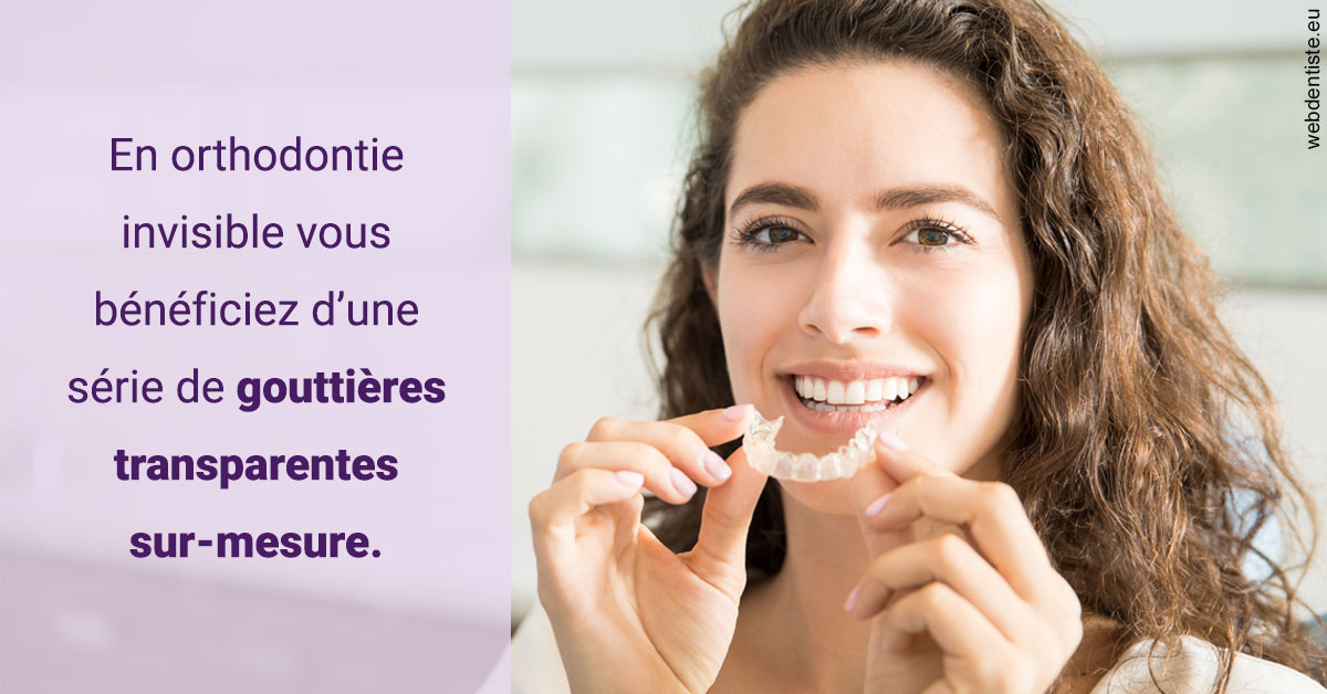 https://www.scm-adn-chirurgiens-dentistes.fr/Orthodontie invisible 1