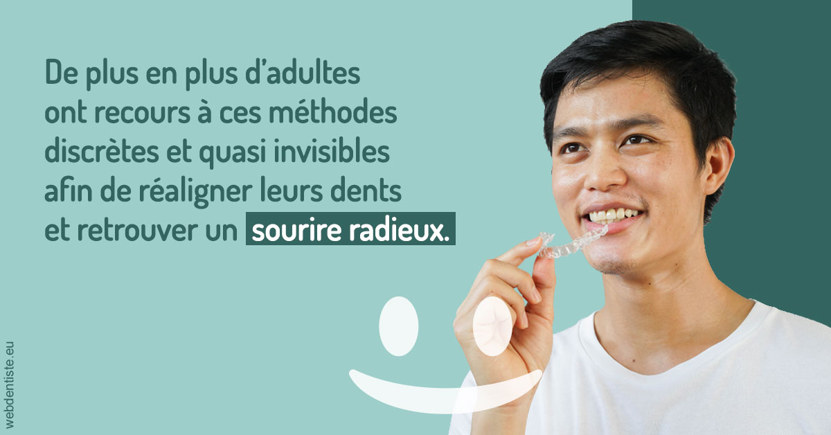 https://www.scm-adn-chirurgiens-dentistes.fr/Gouttières sourire radieux 2