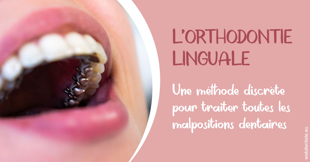 https://www.scm-adn-chirurgiens-dentistes.fr/L'orthodontie linguale 2