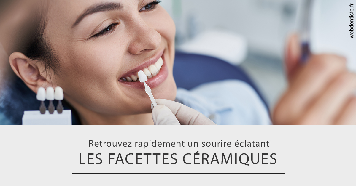 https://www.scm-adn-chirurgiens-dentistes.fr/Les facettes céramiques 2