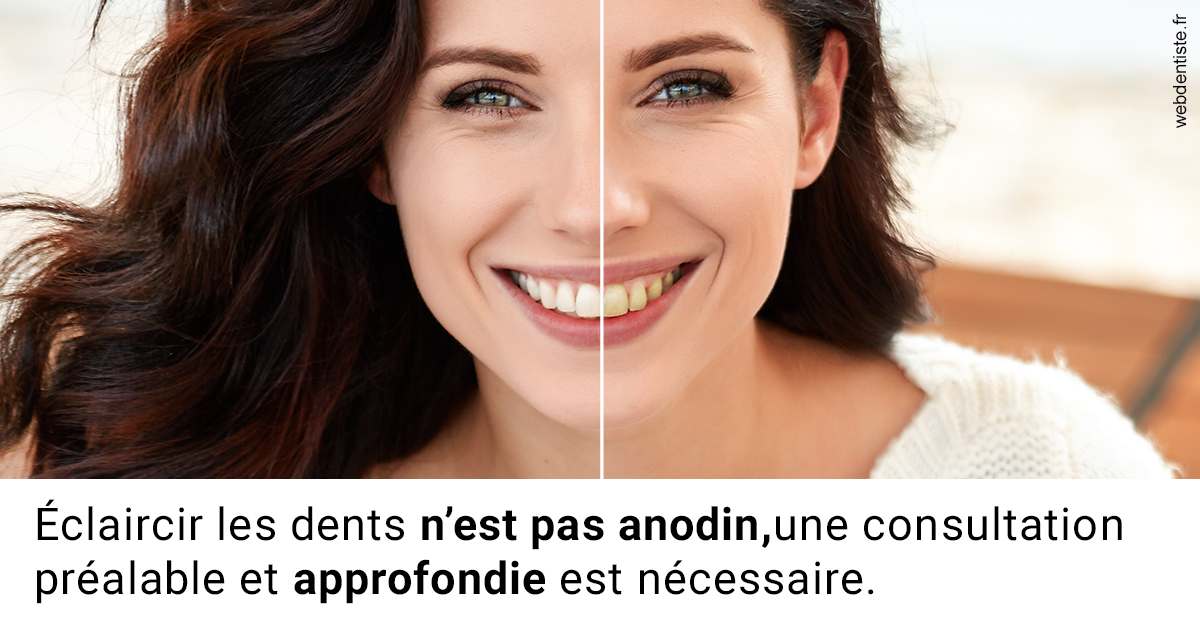 https://www.scm-adn-chirurgiens-dentistes.fr/Le blanchiment 2