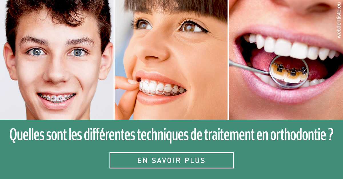 https://www.scm-adn-chirurgiens-dentistes.fr/Les différentes techniques de traitement 2