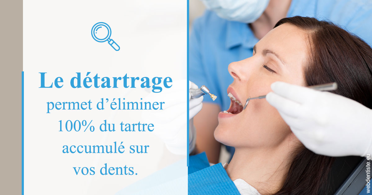 https://www.scm-adn-chirurgiens-dentistes.fr/En quoi consiste le détartrage