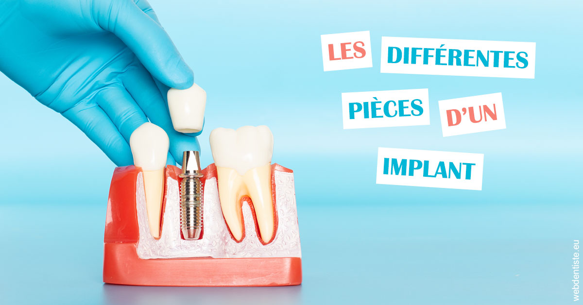 https://www.scm-adn-chirurgiens-dentistes.fr/Les différentes pièces d’un implant 2