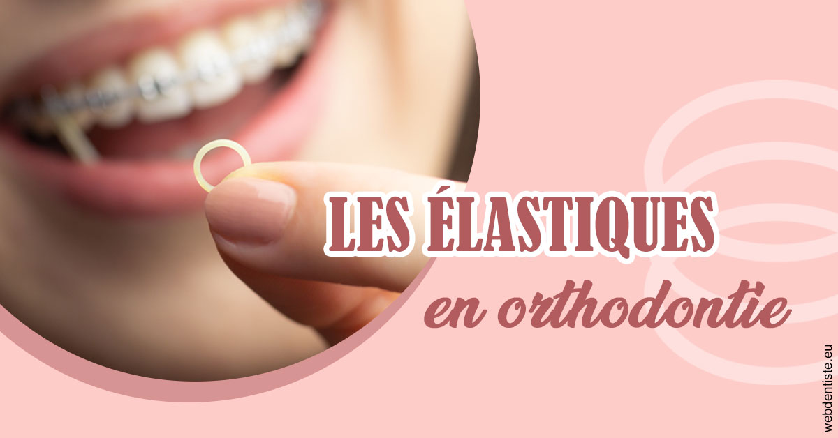 https://www.scm-adn-chirurgiens-dentistes.fr/Elastiques orthodontie 1