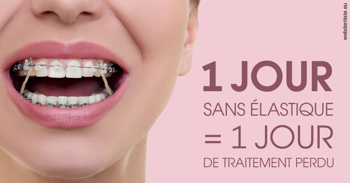 https://www.scm-adn-chirurgiens-dentistes.fr/Elastiques 2