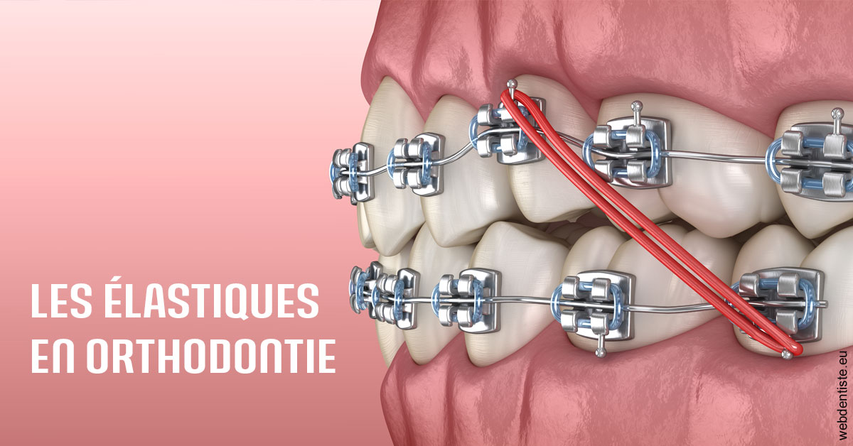 https://www.scm-adn-chirurgiens-dentistes.fr/Elastiques orthodontie 2