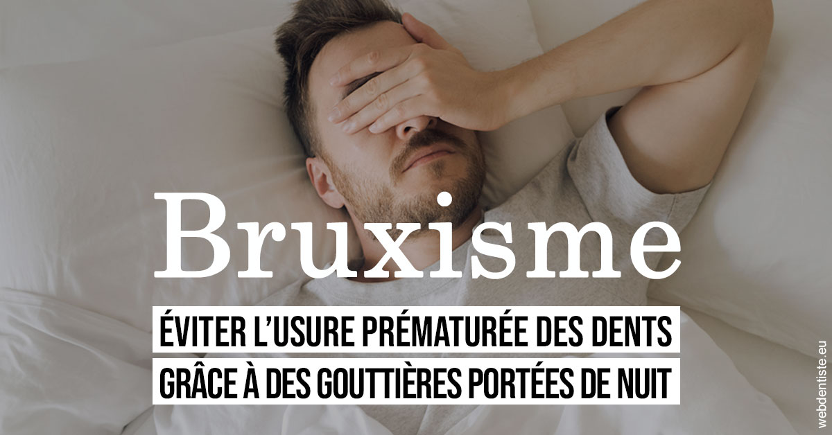 https://www.scm-adn-chirurgiens-dentistes.fr/Bruxisme 1