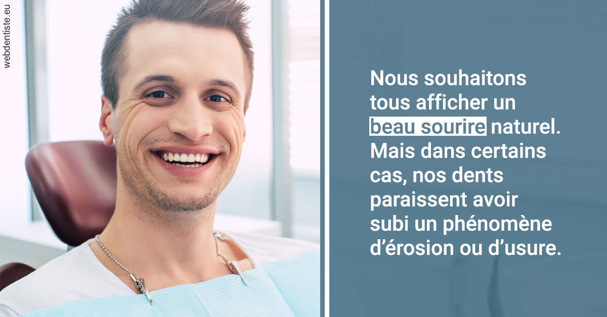 https://www.scm-adn-chirurgiens-dentistes.fr/Érosion et usure dentaire