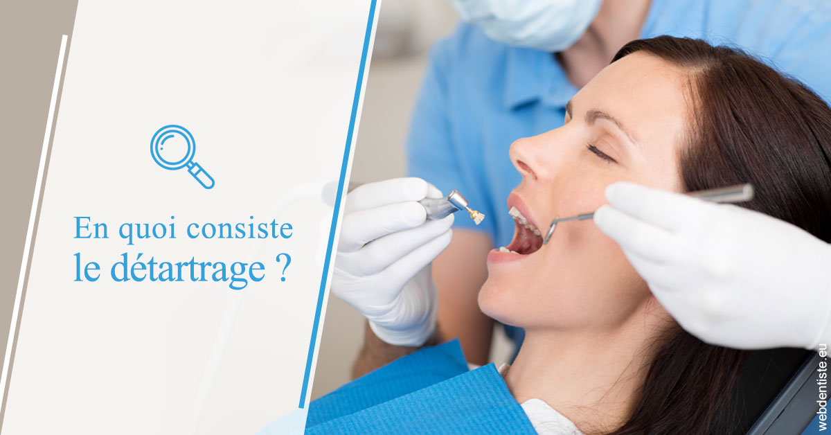 https://www.scm-adn-chirurgiens-dentistes.fr/En quoi consiste le détartrage