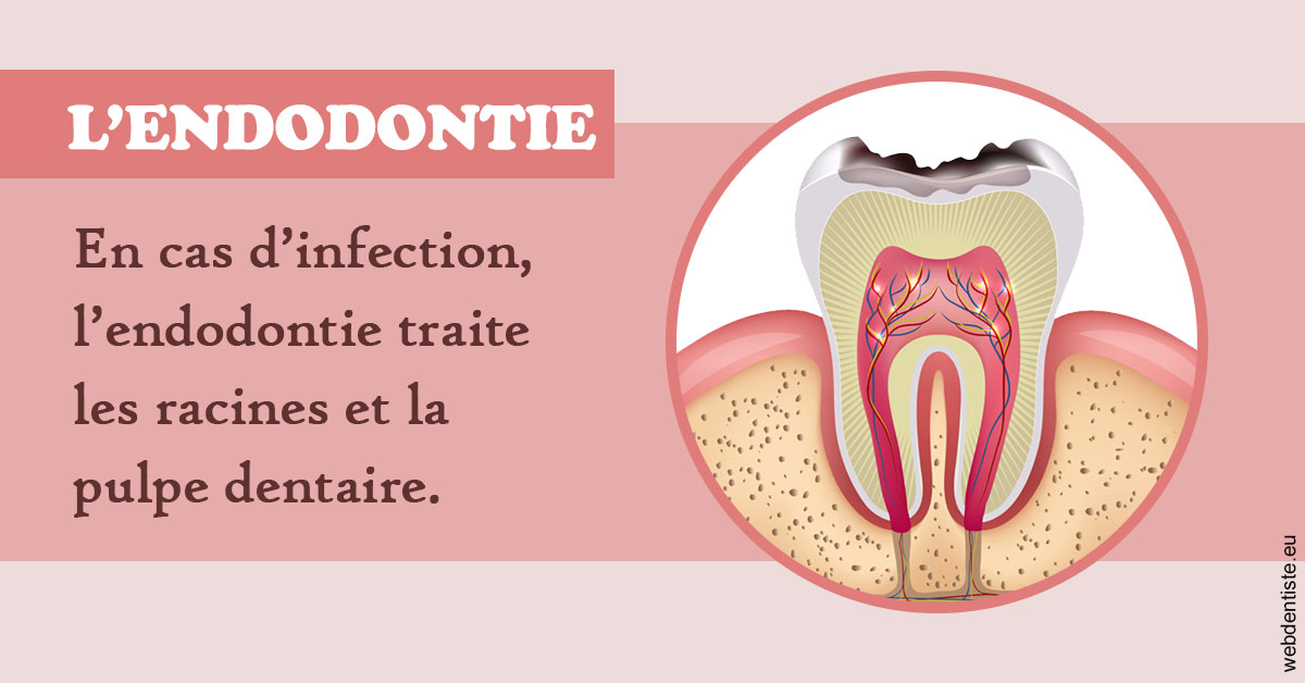 https://www.scm-adn-chirurgiens-dentistes.fr/L'endodontie 2