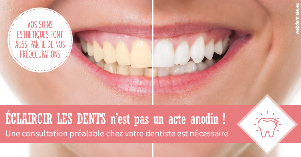 https://www.scm-adn-chirurgiens-dentistes.fr/Eclaircir les dents 1