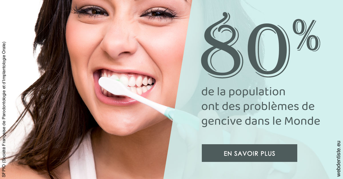 https://www.scm-adn-chirurgiens-dentistes.fr/Problèmes de gencive 1